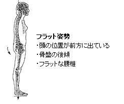 フラット姿勢・頭の位置が前方に出ている・骨盤の後傾・フラットな腰椎 