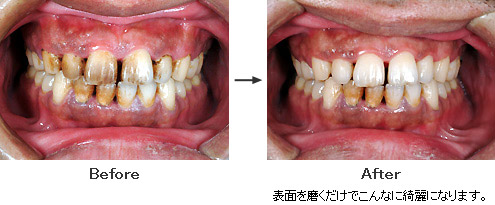 表面を磨くだけでこんなに綺麗になります。