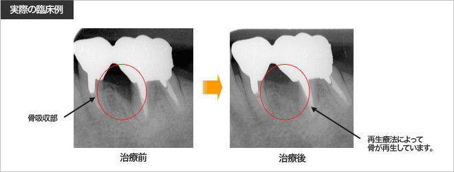 実際の臨床例