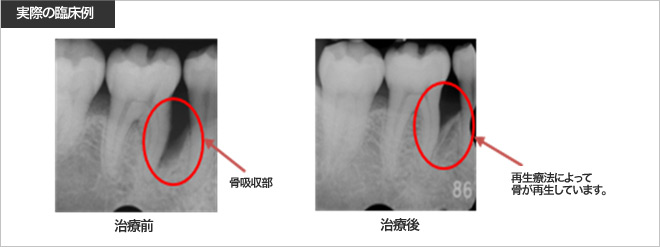 実際の臨床例