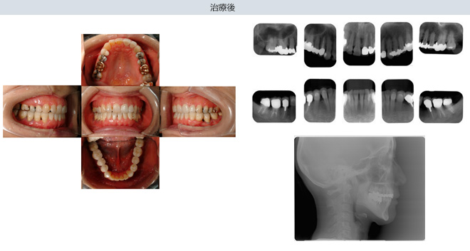 症例写真